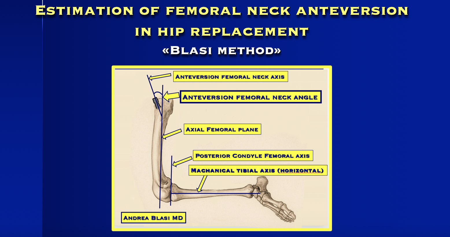 Blasi method