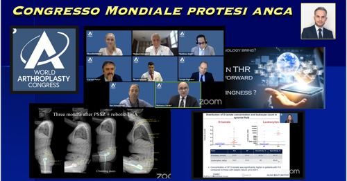 Congresso mondiale protesi anca