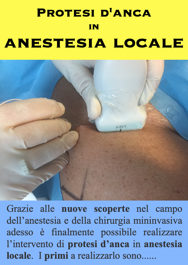 Protesi danca in anestesia locale link