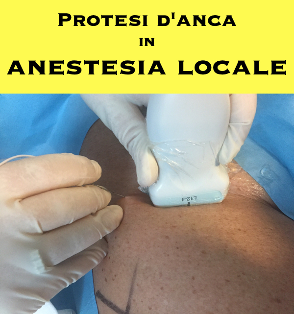 Protesi danca in anestesia locale