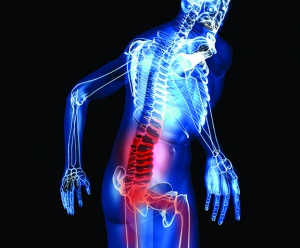 Sindrome anca-schiena