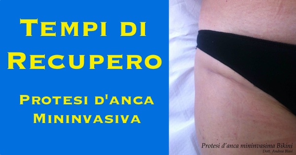 Tempi di recupero Protesi anca mininvasiva bikini 