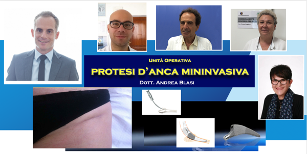 UO protesi anca mininvasiva web